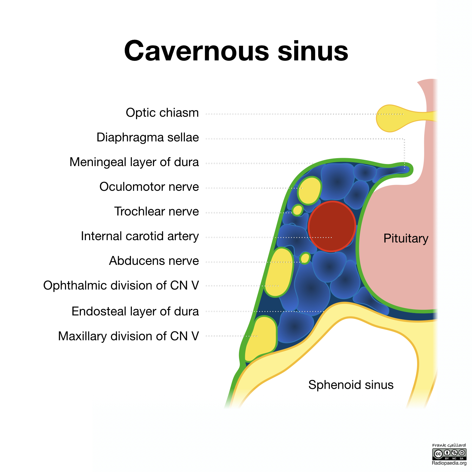 Radiopaedia Drawing Contents Of The Cavernous Sinus English Labels   24 Cavernous Sinus Illustration 1 (1) 